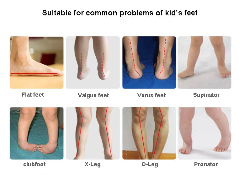 Ortoluckland Children Girl Shoes Princess Orthopedic Pink Sandals For Kids Toddler Flower Leather Footwear With Orthotic Insoles